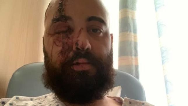 NERVECELL Drummer BACHIR RAMADAN Caught In Beirut Explosion; On The Road To Recovery