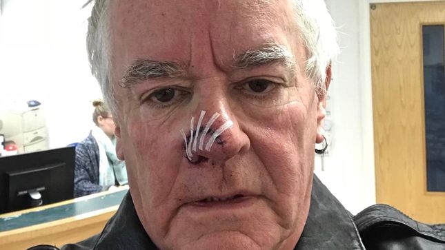 SAXON Drummer NIGEL GLOCKLER Has Nose Reattached After Dog Attack